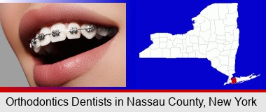 orthodontic braces; Nassau County highlighted in red on a map