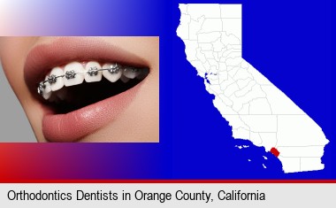 orthodontic braces; Orange County highlighted in red on a map