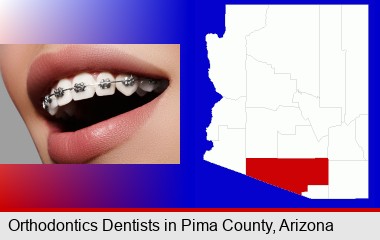 orthodontic braces; Pima County highlighted in red on a map