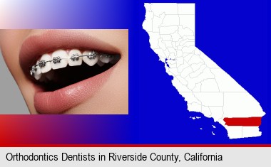 orthodontic braces; Riverside County highlighted in red on a map