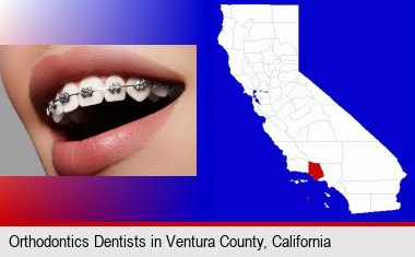 orthodontic braces; Ventura County highlighted in red on a map