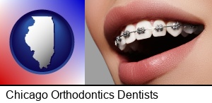 Chicago, Illinois - orthodontic braces