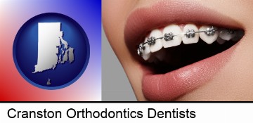 orthodontic braces in Cranston, RI