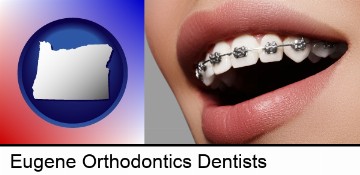 orthodontic braces in Eugene, OR