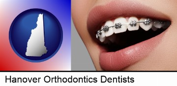 orthodontic braces in Hanover, NH