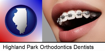 orthodontic braces in Highland Park, IL