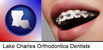 orthodontic braces in Lake Charles, LA
