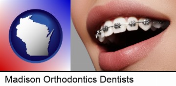 orthodontic braces in Madison, WI