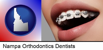 orthodontic braces in Nampa, ID
