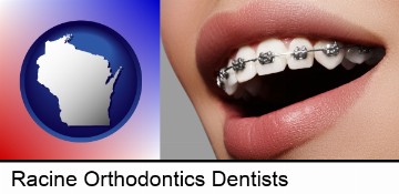 orthodontic braces in Racine, WI