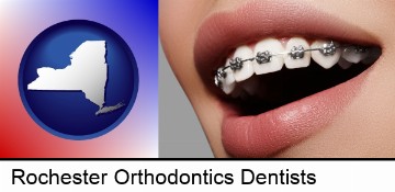 orthodontic braces in Rochester, NY