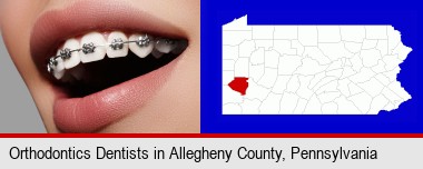 orthodontic braces; Allegheny County highlighted in red on a map