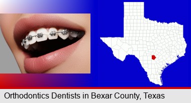 orthodontic braces; Bexar County highlighted in red on a map