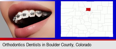 orthodontic braces; Boulder County highlighted in red on a map
