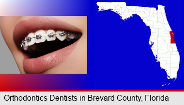orthodontic braces; Brevard County highlighted in red on a map