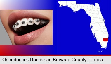 orthodontic braces; Broward County highlighted in red on a map