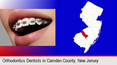 orthodontic braces; Camden County highlighted in red on a map