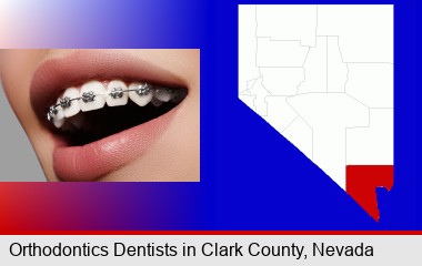 orthodontic braces; Clark County highlighted in red on a map
