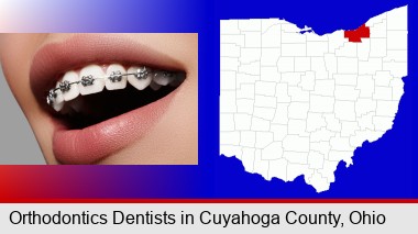 orthodontic braces; Cuyahoga County highlighted in red on a map