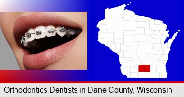 orthodontic braces; Dane County highlighted in red on a map