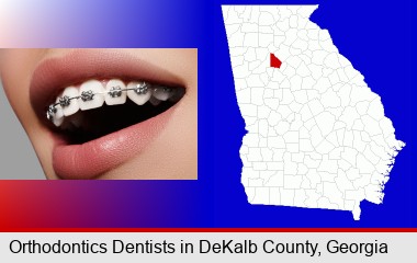 orthodontic braces; DeKalb County highlighted in red on a map