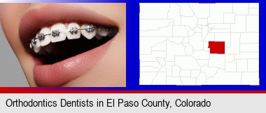 orthodontic braces; Elbert County highlighted in red on a map