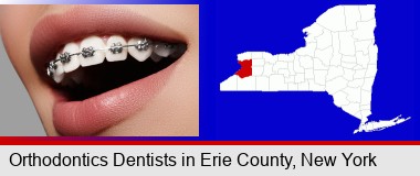 orthodontic braces; Erie County highlighted in red on a map