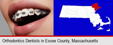 orthodontic braces; Essex County highlighted in red on a map