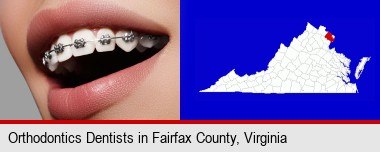 orthodontic braces; Fairfax County highlighted in red on a map
