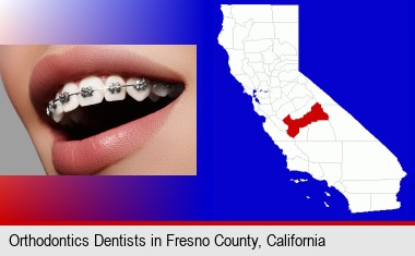 orthodontic braces; Fresno County highlighted in red on a map