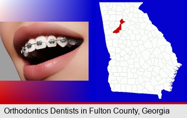 orthodontic braces; Fulton County highlighted in red on a map