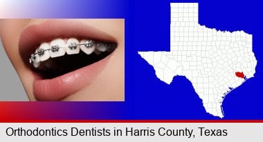 orthodontic braces; Harris County highlighted in red on a map