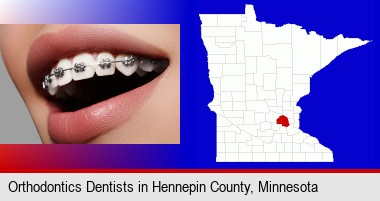 orthodontic braces; Hennepin County highlighted in red on a map