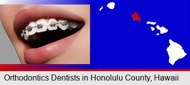 orthodontic braces; Honolulu County highlighted in red on a map