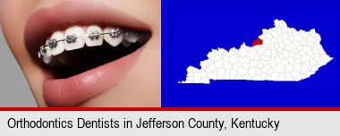 orthodontic braces; Jefferson County highlighted in red on a map
