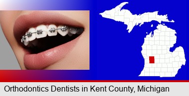 orthodontic braces; Kent County highlighted in red on a map