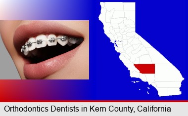 orthodontic braces; Kern County highlighted in red on a map