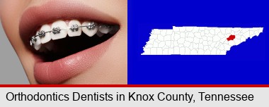 orthodontic braces; Knox County highlighted in red on a map