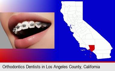 orthodontic braces; Los Angeles County highlighted in red on a map