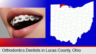 orthodontic braces; Lucas County highlighted in red on a map