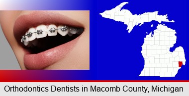 orthodontic braces; Macomb County highlighted in red on a map