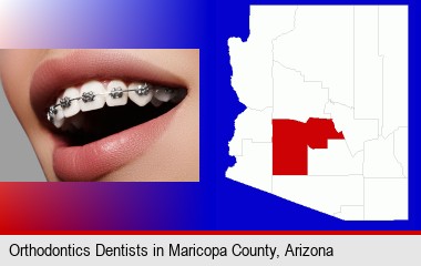 orthodontic braces; Maricopa County highlighted in red on a map
