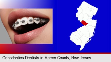 orthodontic braces; Mercer County highlighted in red on a map