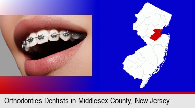 orthodontic braces; Middlesex County highlighted in red on a map
