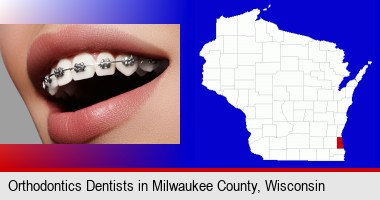 orthodontic braces; Milwaukee County highlighted in red on a map