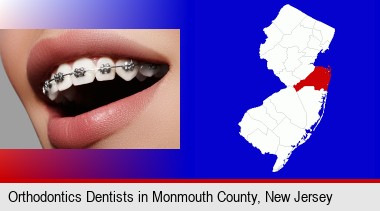 orthodontic braces; Monmouth County highlighted in red on a map
