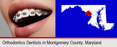 orthodontic braces; Montgomery County highlighted in red on a map