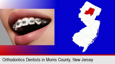 orthodontic braces; Morris County highlighted in red on a map