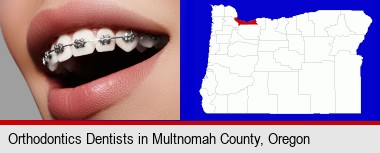 orthodontic braces; Multnomah County highlighted in red on a map