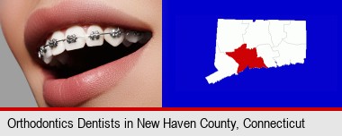 orthodontic braces; New Haven County highlighted in red on a map